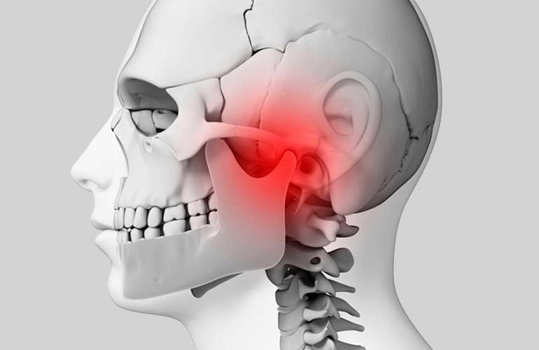 Disfunção Temporomandibular - DTM